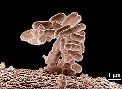 e coli